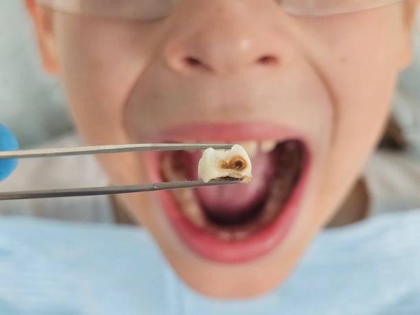 Best Broken Tooth Emergency  in Dyer, IN